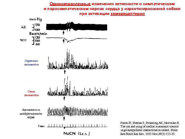 Однонаправленные изменения активности в симпатическом и парасимпатическом нервах сердца у наркотизированной собаки при активации