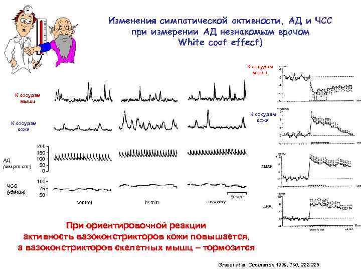 Изменения симпатической активности, АД и ЧСС при измерении АД незнакомым врачом White coat effect)