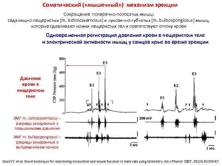 Соматический ( «мышечный» ) механизм эрекции Сокращение поперечно-полосатых мышц: седалищно-пещеристых (m. ischiocavernosus) и луковично-губчатых