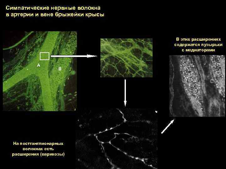 Симпатические нервные волокна в артерии и вене брыжейки крысы В этих расширениях содержатся пузырьки
