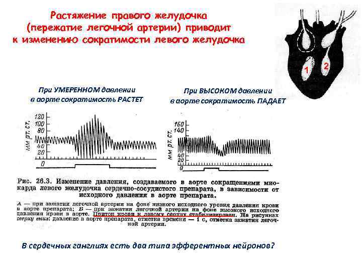 Растяжение правого желудочка (пережатие легочной артерии) приводит к изменению сократимости левого желудочка 1 При