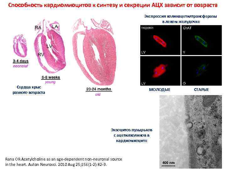 Способность кардиомиоцитов к синтезу и секреции АЦХ зависит от возраста Экспрессия холинацетилтрансферазы в левом