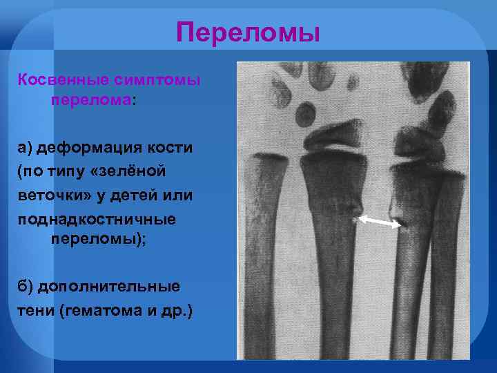 Тип зеленой веточки