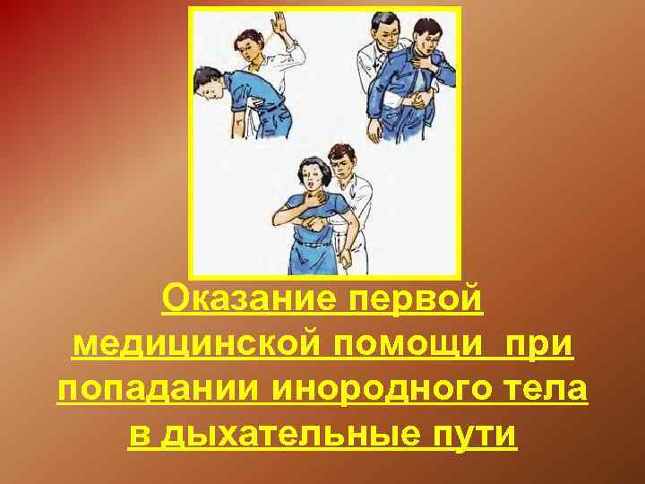 Оказание первой помощи при попадании инородного тела в дыхательные пути презентация