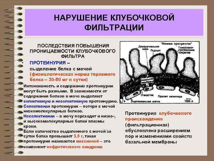 НАРУШЕНИЕ КЛУБОЧКОВОЙ ФИЛЬТРАЦИИ • ПОСЛЕДСТВИЯ ПОВЫШЕНИЯ ПРОНИЦАЕМОСТИ КЛУБОЧКОВОГО ФИЛЬТРА ПРОТЕИНУРИЯ – выделение белка с