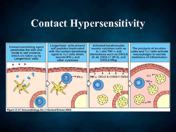 Contact Hypersensitivity 