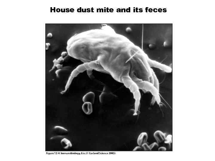 House dust mite and its feces Figure 12 -4 