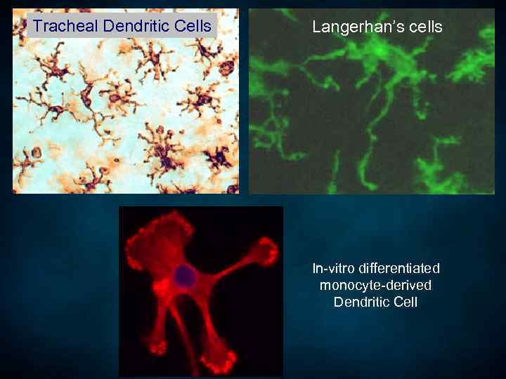 Tracheal Dendritic Cells Langerhan’s cells In-vitro differentiated monocyte-derived Dendritic Cell 