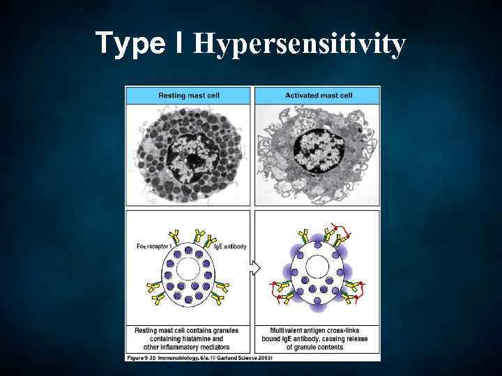 Type I Hypersensitivity 