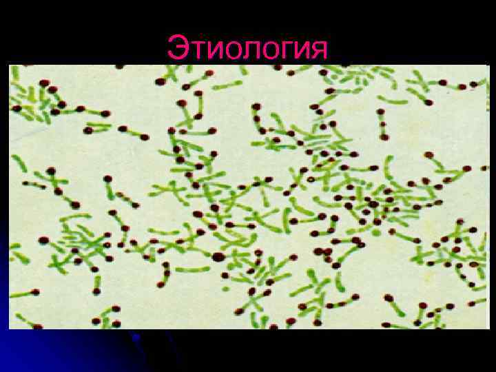 Этиология 
