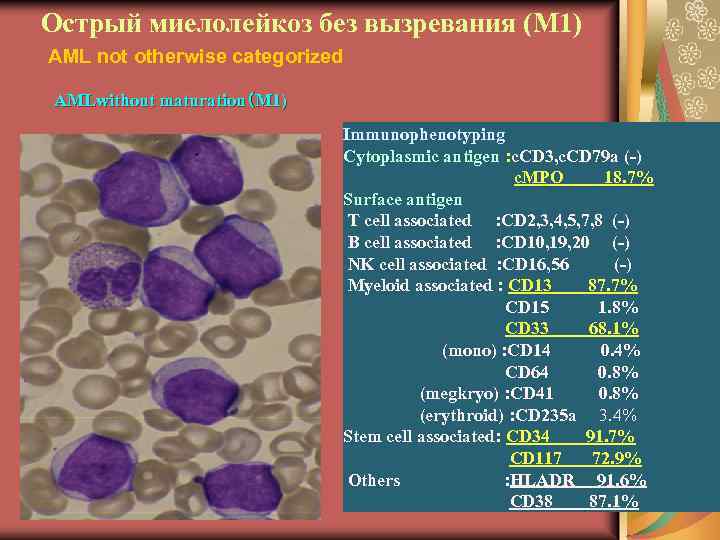 Острый миелолейкоз без вызревания (М 1) AML not otherwise categorized AMLwithout maturation（M 1) Immunophenotyping