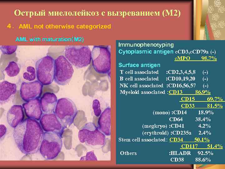 Острый миелолейкоз с вызреванием (М 2) ４．AML not otherwise categorized AML with maturation（M 2)