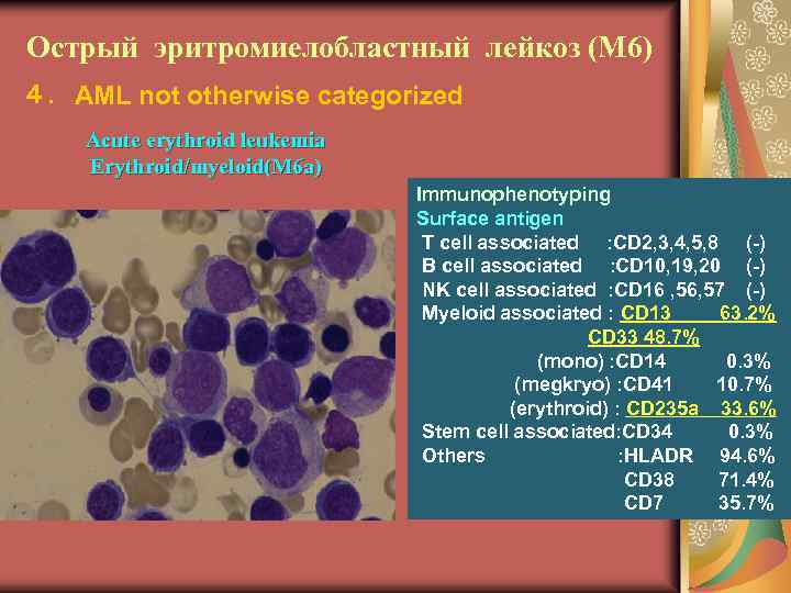 Острый эритромиелобластный лейкоз (М 6) ４．AML not otherwise categorized Acute erythroid leukemia Erythroid/myeloid(M 6