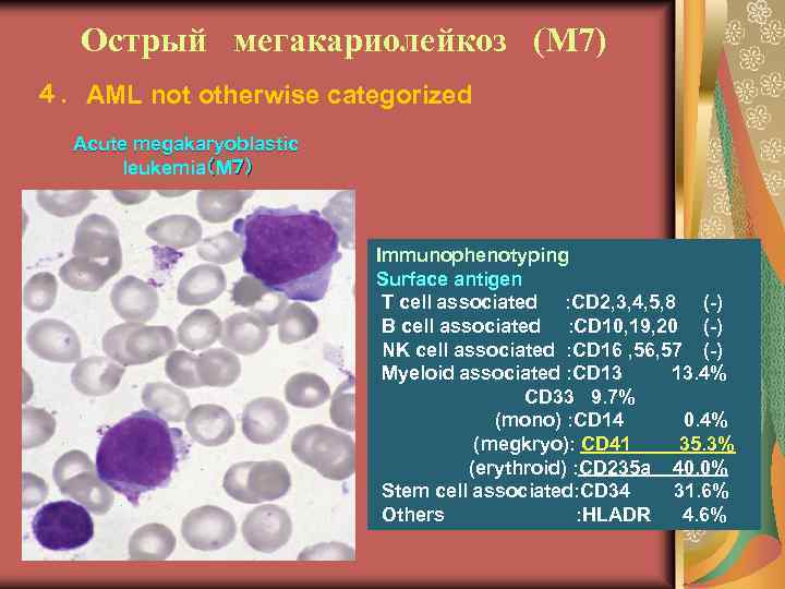 Острый мегакариолейкоз (М 7) ４．AML not otherwise categorized Acute megakaryoblastic leukemia（M７） Immunophenotyping Surface antigen