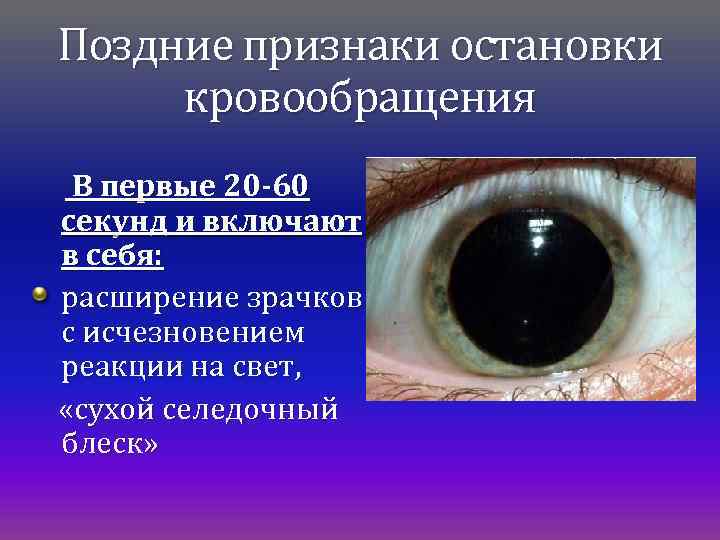 Поздние признаки остановки кровообращения В первые 20 -60 секунд и включают в себя: расширение