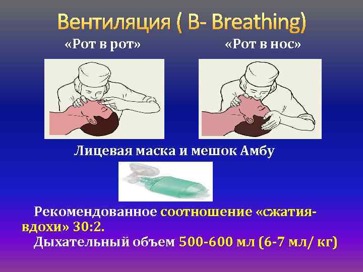 Частота проведения искусственного дыхания. Проведение искусственного дыхания рот в нос. Искусственная вентиляция легких методом рот в нос. Сердечно-легочная реанимация рот ко рту. Вентиляция легких рот в нос.