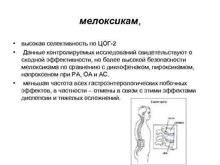 мелоксикам, • высокая селективность по ЦОГ-2 • Данные контролируемых исследований свидетельствуют о сходной эффективности,