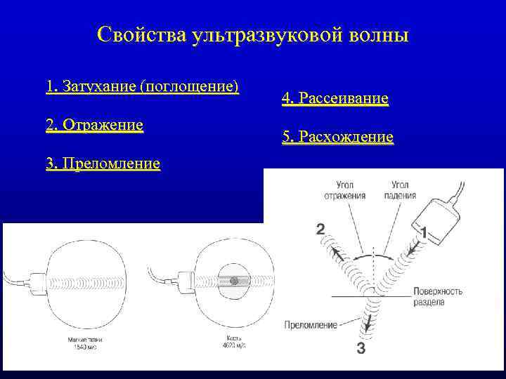 Свойства ультразвуковой волны 1. Затухание (поглощение) 2. Отражение 3. Преломление 4. Рассеивание 5. Расхождение