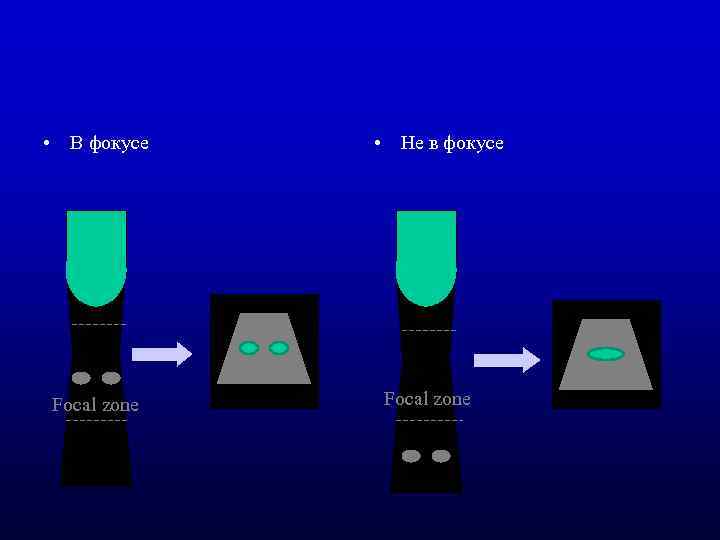  • В фокусе Focal zone • Не в фокусе Focal zone 