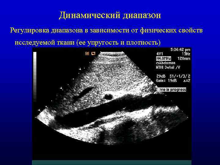 Динамический диапазон Регулировка диапазона в зависимости от физических свойств исследуемой ткани (ее упругость и