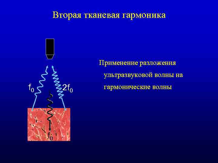 Вторая тканевая гармоника Применение разложения ультразвуковой волны на f 0 2 f 0 гармонические