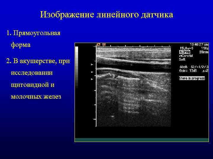 Изображение линейного датчика 1. Прямоугольная форма 2. В акушерстве, при исследовании щитовидной и молочных
