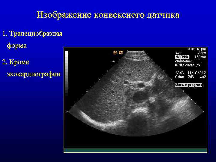 Изображение конвексного датчика 1. Трапециобразная форма 2. Кроме эхокардиографии 