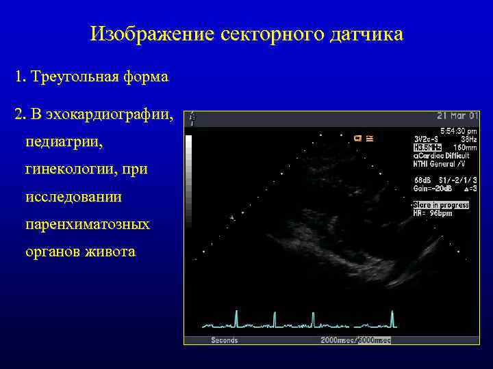 Изображение секторного датчика 1. Треугольная форма 2. В эхокардиографии, педиатрии, гинекологии, при исследовании паренхиматозных