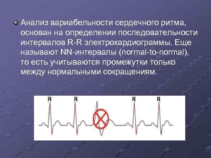 Анализ вариабельности сердечного ритма, основан на определении последовательности интервалов R-R электрокардиограммы. Еще называют NN-интервалы