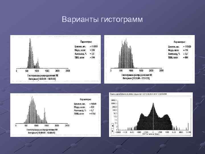 Варианты гистограмм 