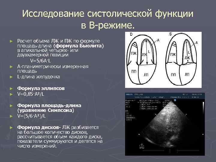 Эхокардиография в таблицах и схемах рыбакова митьков