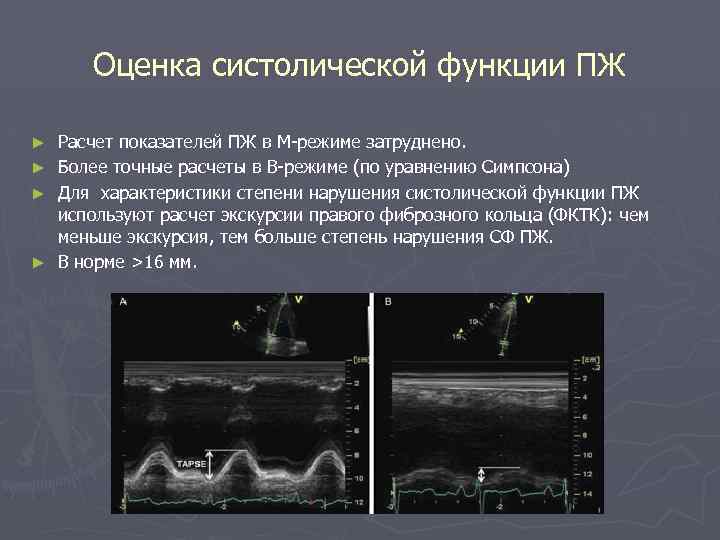 Эхокардиография в таблицах и схемах рыбакова митьков