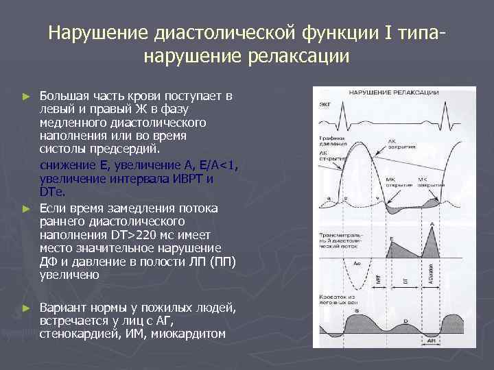 Нарушение диастолической функции I типанарушение релаксации Большая часть крови поступает в левый и правый