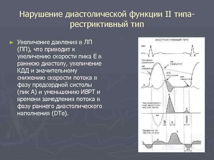 Нарушение диастолической функции II типаpестриктивный тип ► Увеличение давления в ЛП (ПП), что приводит