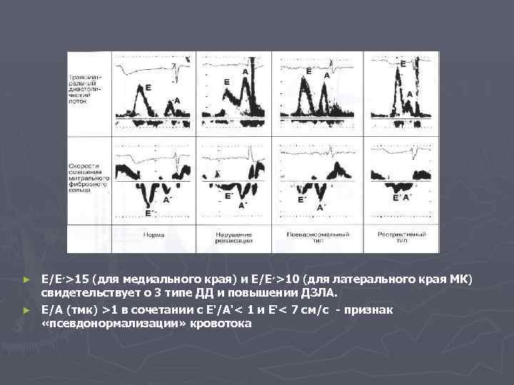 Е/Е ( 51>׳ для медиального края) и Е/Е ( 01>׳ для латерального края МК)