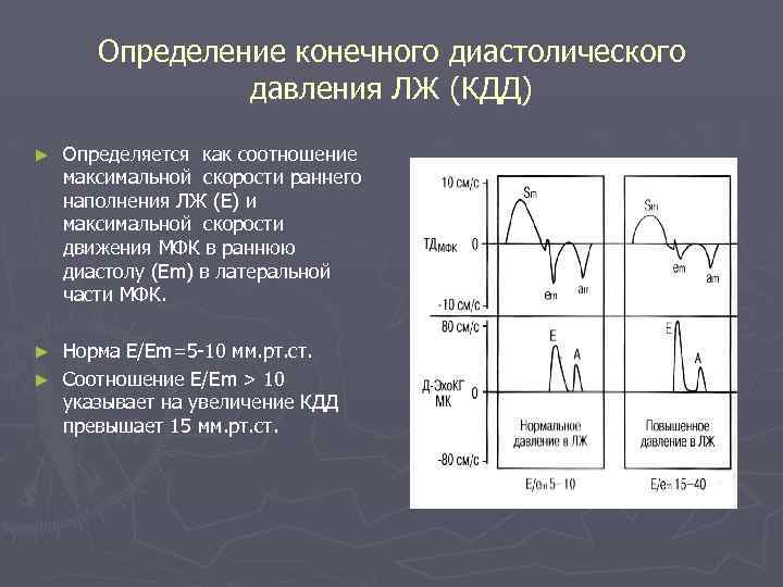 Рыбакова эхокардиография в таблицах и схемах