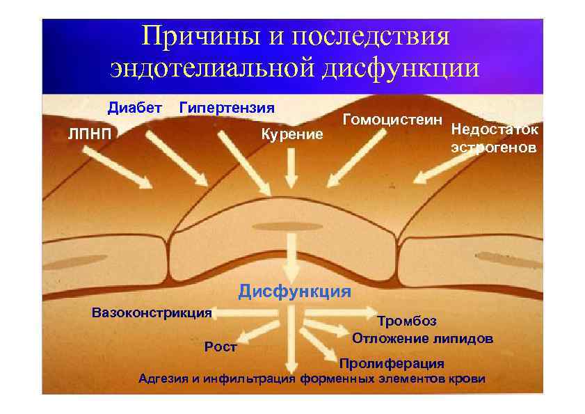Причины и последствия эндотелиальной дисфункции Диабет Гипертензия ЛПНП Курение Гомоцистеин Недостаток эстрогенов Дисфункция Вазоконстрикция