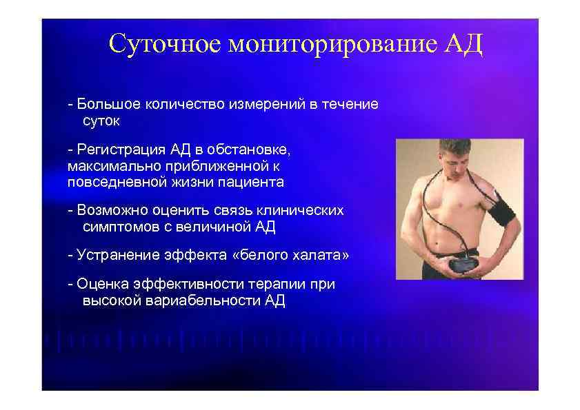 Суточное мониторирование АД - Большое количество измерений в течение суток - Регистрация АД в