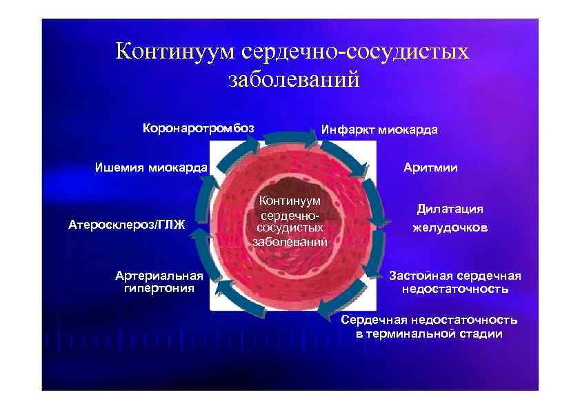 Инфаркт миокарда факультетская терапия презентация