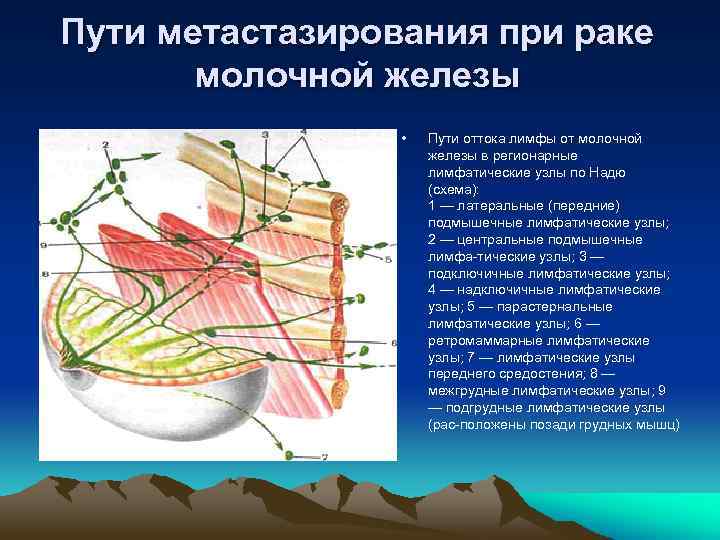 Втяжение кожи при раке молочной железы фото