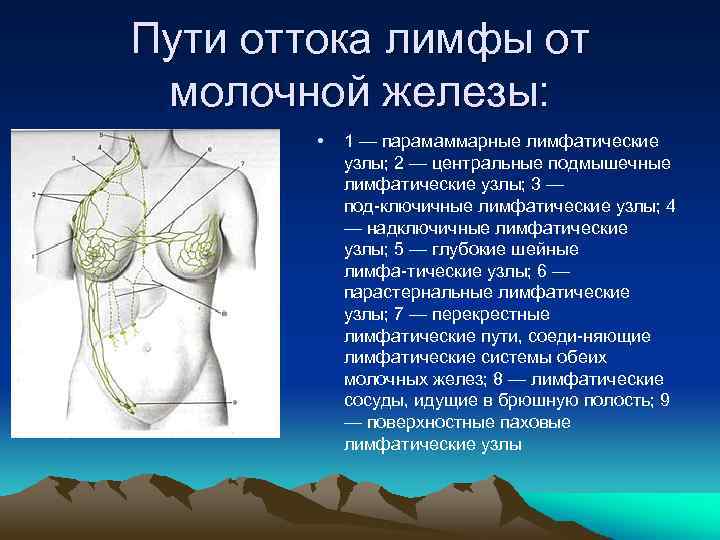 Пути оттока лимфы от молочной железы: • 1 — парамаммарные лимфатические узлы; 2 —
