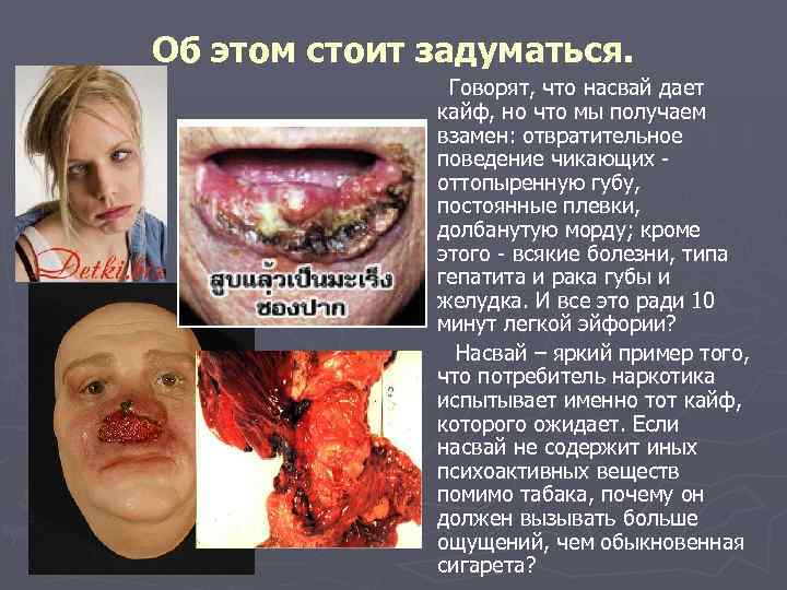 Об этом стоит задуматься. Говорят, что насвай дает кайф, но что мы получаем взамен: