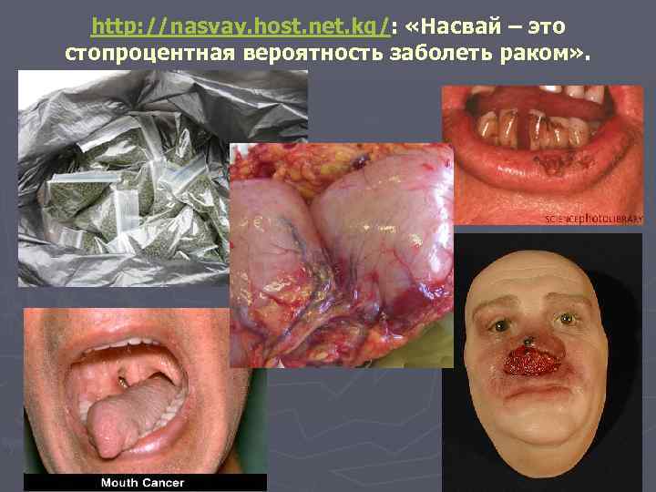 http: //nasvay. host. net. kg/: «Насвай – это стопроцентная вероятность заболеть раком» . 