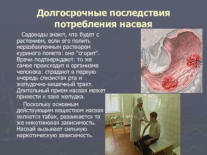 Долгосрочные последствия потребления насвая Садоводы знают, что будет с растением, если его полить неразбавленным