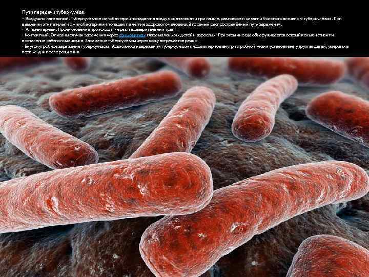 Пути передачи туберкулёза: - Воздушно-капельный. Туберкулёзные микобактерии попадают в воздух с капельками при кашле,