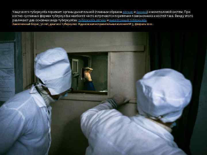 Чаще всего туберкулёз поражает органы дыхательной (главным образом лёгкие и бронхи) и мочеполовой систем.