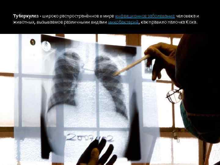Туберкулез - широко распространённое в мире инфекционное заболевание человека и животных, вызываемое различными видами