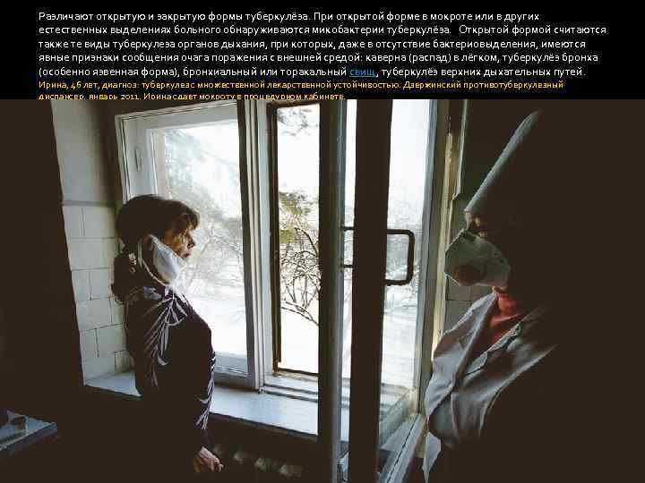 Различают открытую и закрытую формы туберкулёза. При открытой форме в мокроте или в других