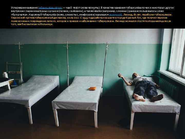 Устаревшее название туберкулёза лёгких — чахо тка (от слова чахнуть). В качестве названия туберкулёза