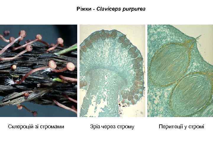 Ріжки - Claviceps purpurea Склероцій зі стромами Зріз через строму Перитеції у стромі 